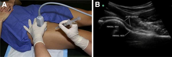 Tratamento de Fraturas | Cirurgias | Dr. Roni Serra