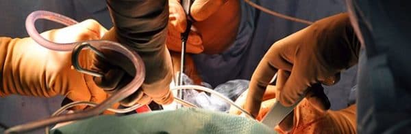 Revisão de Quadril | Cirurgias | Dr. Roni Serra